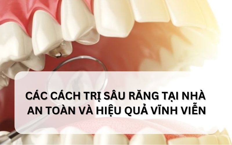 Các cách trị sâu răng tại nhà vĩnh viễn và hiệu quả